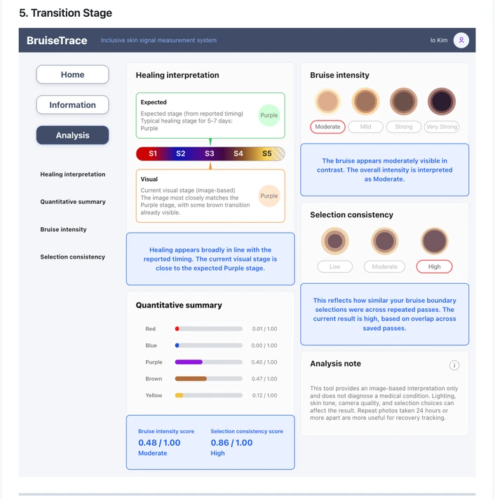 Healing interpretation panel of the BruiseTrace analysis screen